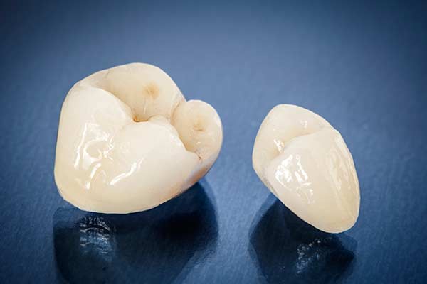 dental crowns