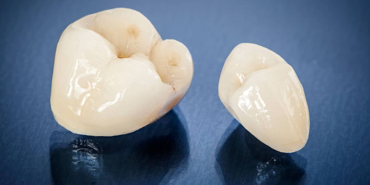 dental crowns