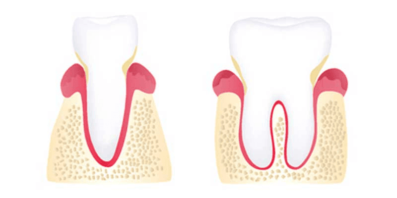 tooth graphic