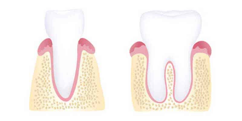 Healthy gums illustration