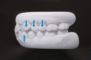 3d model of teeth