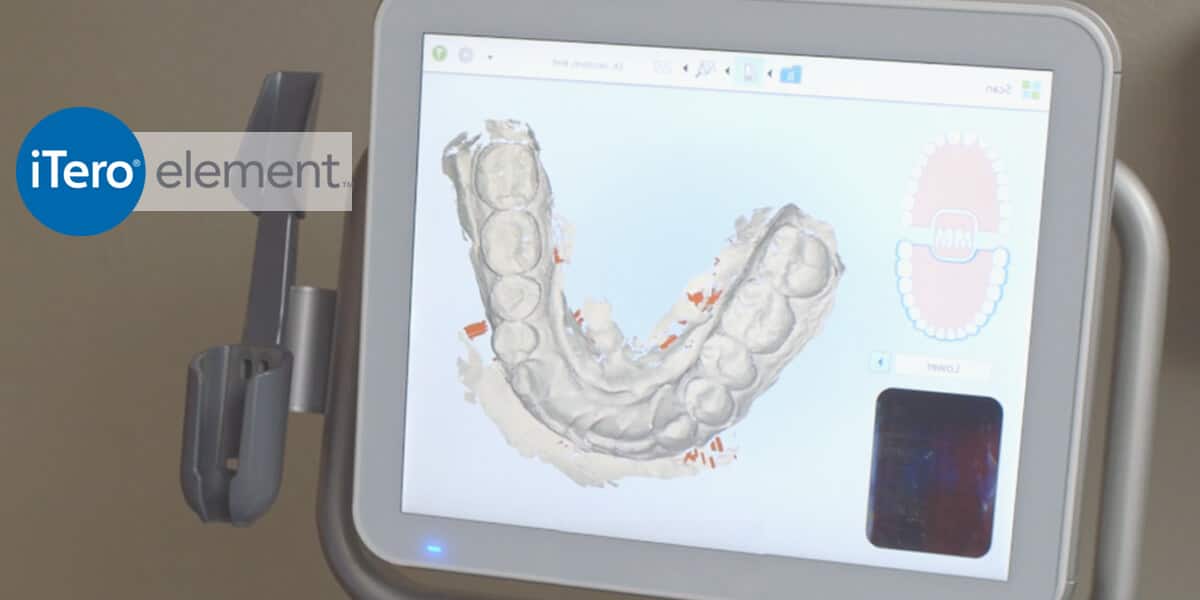 ipad tech tooth picture